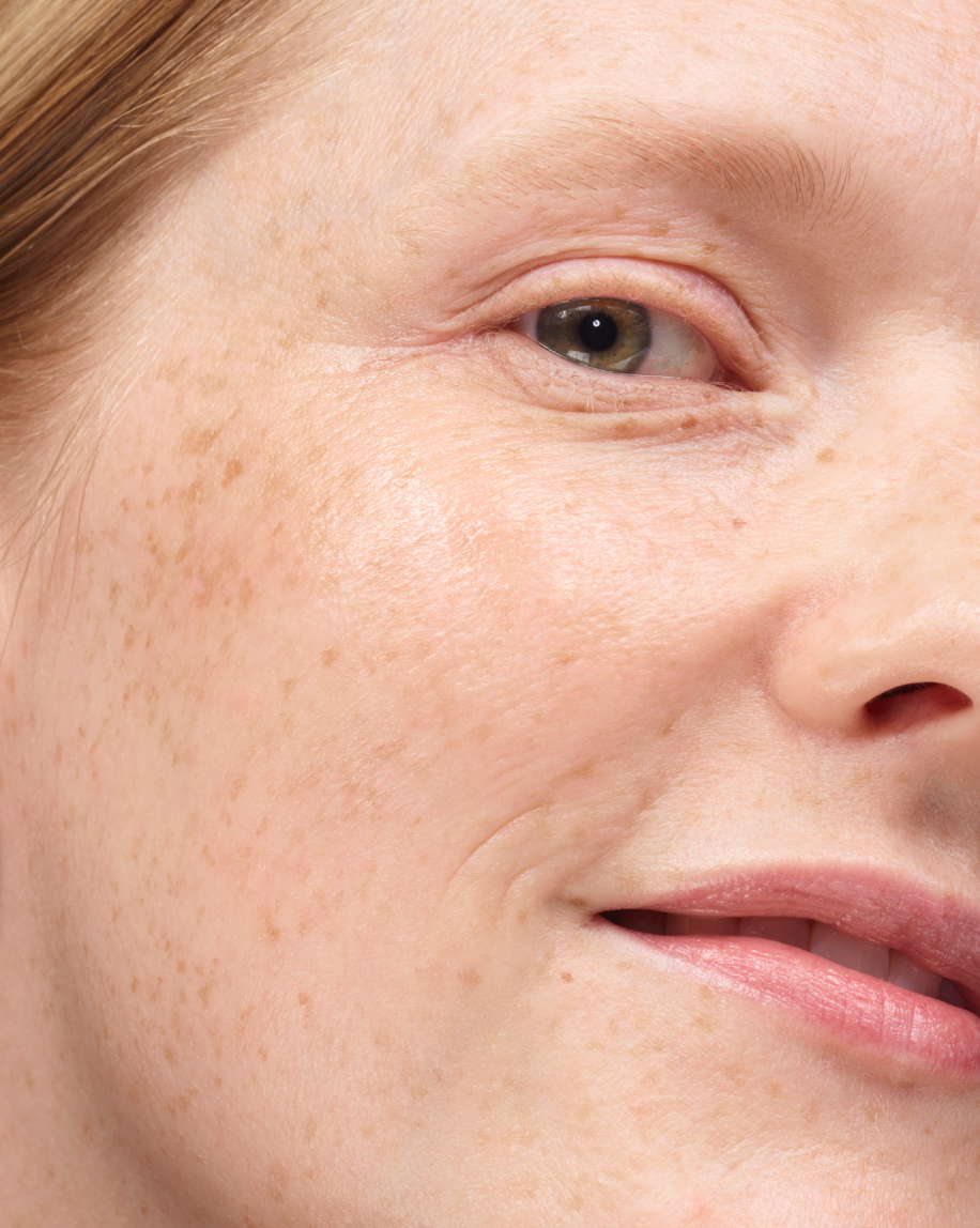 Universal Pro-Retinol